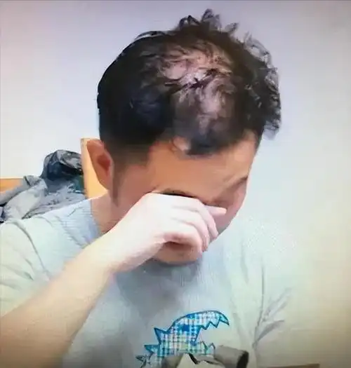 这6位男神中年秃顶从郑少秋到黄晓明个个发际线高到离谱