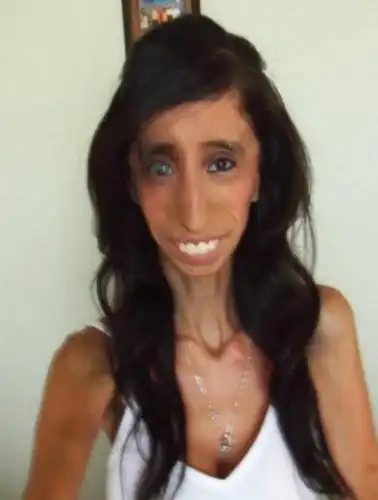 世界上最丑的女人帅哥排着队追求看完你也觉得高攀不起