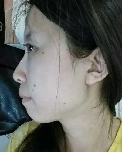 我知道我侧脸丑死