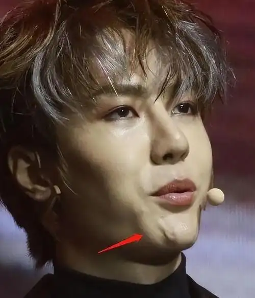 8位改头换命的男明星王一博脸已僵硬刘恺威眼皮才是灵魂