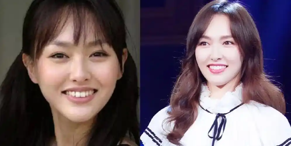 杨紫为什么越来越好看了?_牙齿