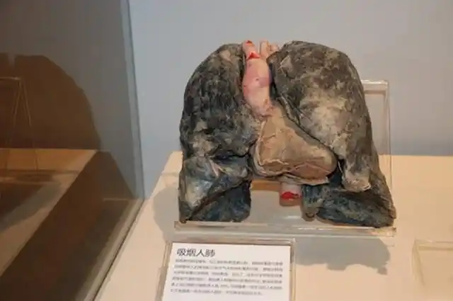 抽烟几十年肺还能恢复正常吗?医生:出现这些症状,戒烟刻不容缓