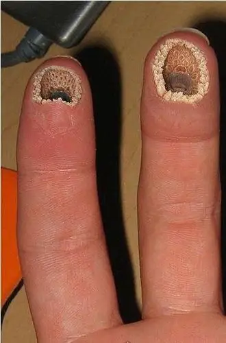 恶心反胃的蓬蓬乳和空空指实际是ps出来的密集恐惧症图