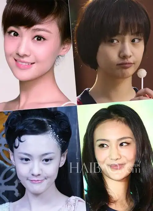 郑爽公开承认整容,昔日俏丽不再令人唏嘘!