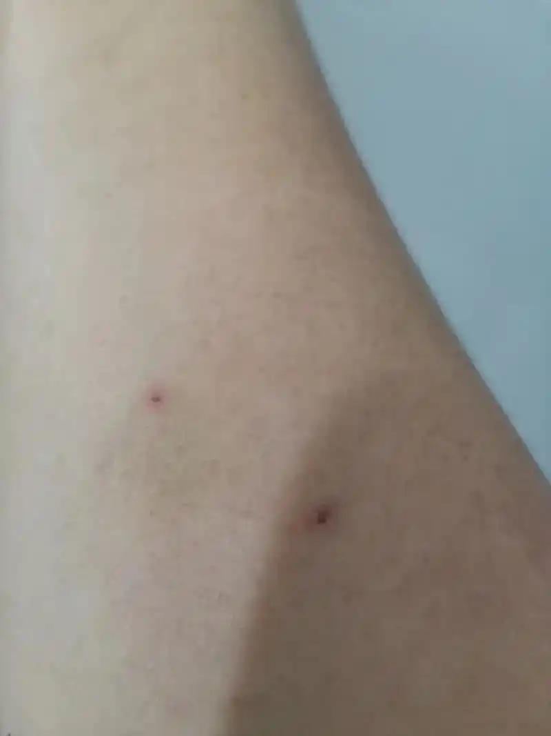 什么都可能经历,什么都会过去,看着全是针孔的手,生命既然是如 - 抖音