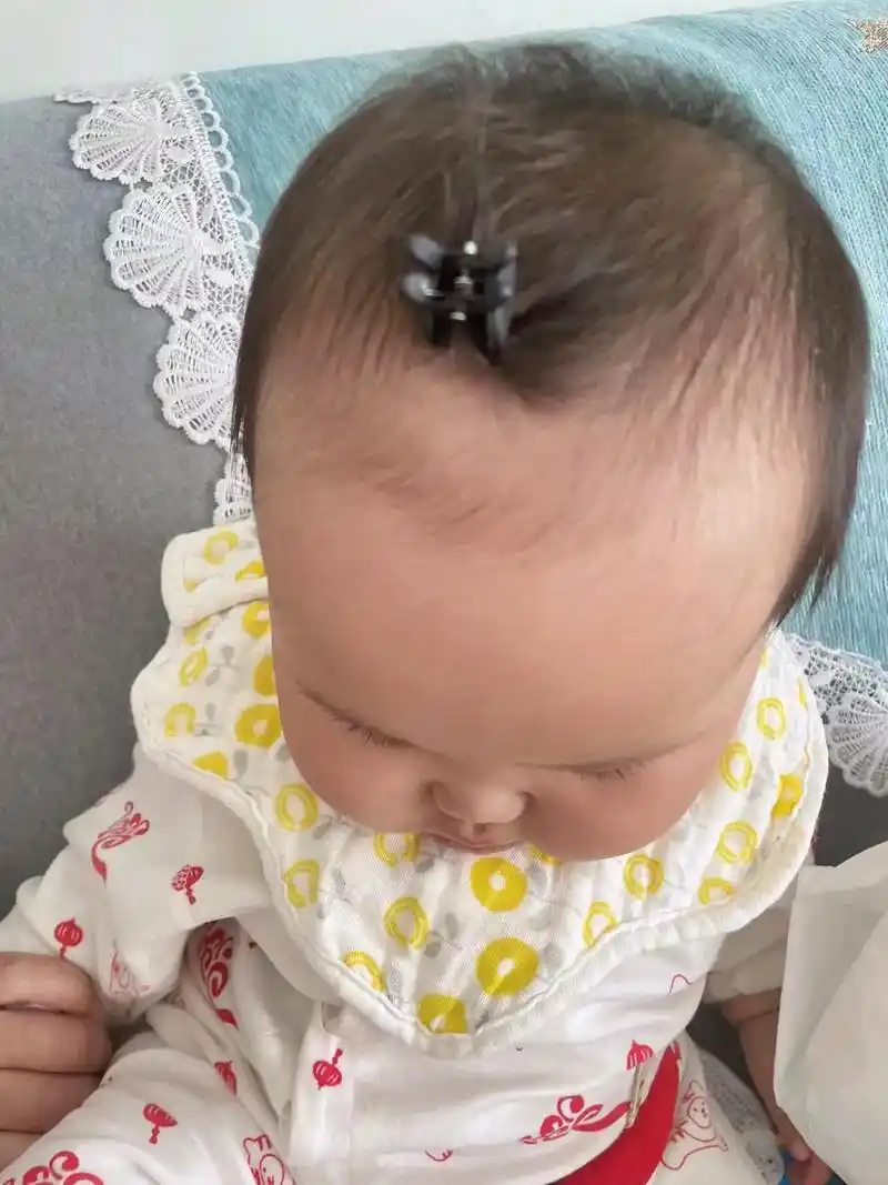 额头大也就算了,发际线还高.研判分 - 抖音