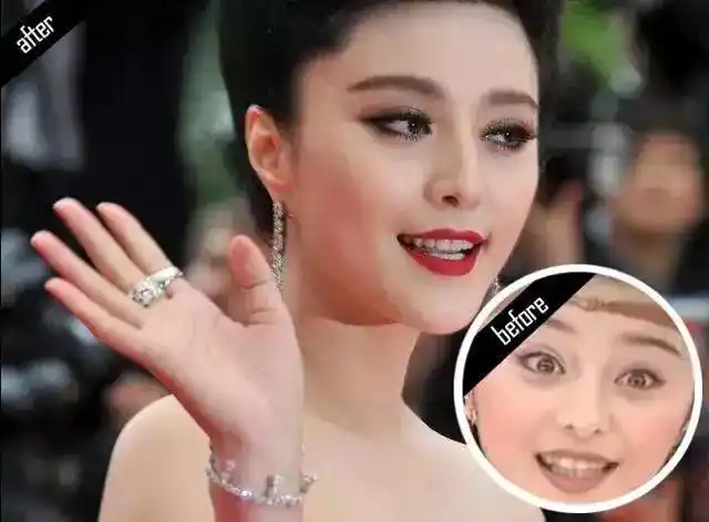 娱乐圈整过牙的明星来证明:牙齿几乎承包了一个人70%的颜值,80%的气质