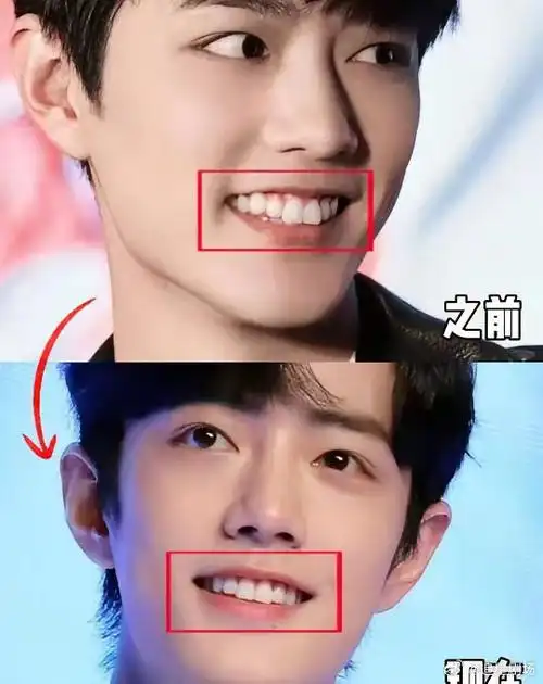 《陈情令》vs《藏海传》,肖战的牙齿不一样了