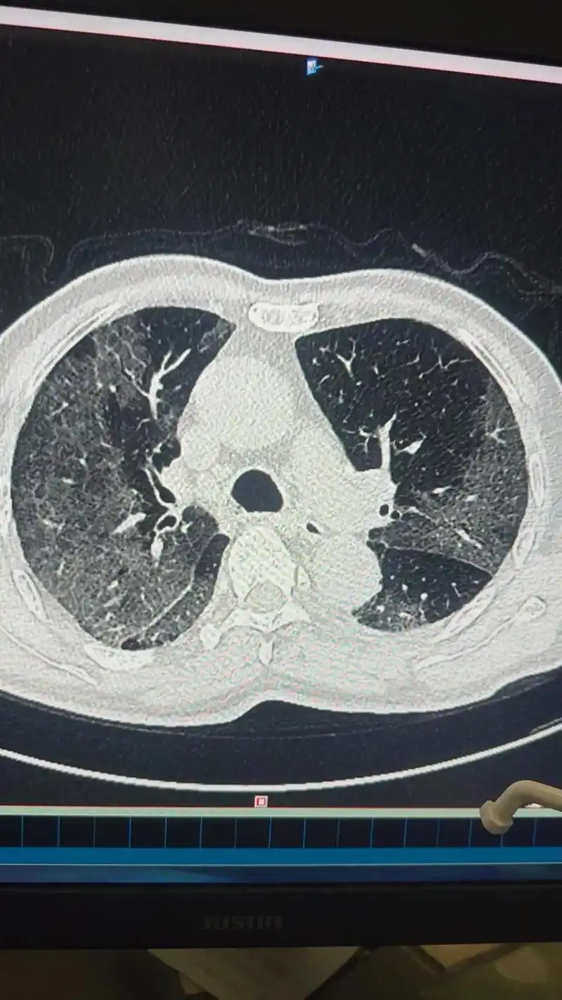 新冠肺炎并没走远   保佑大家百毒不侵 #这是我和进修老师 - 抖音