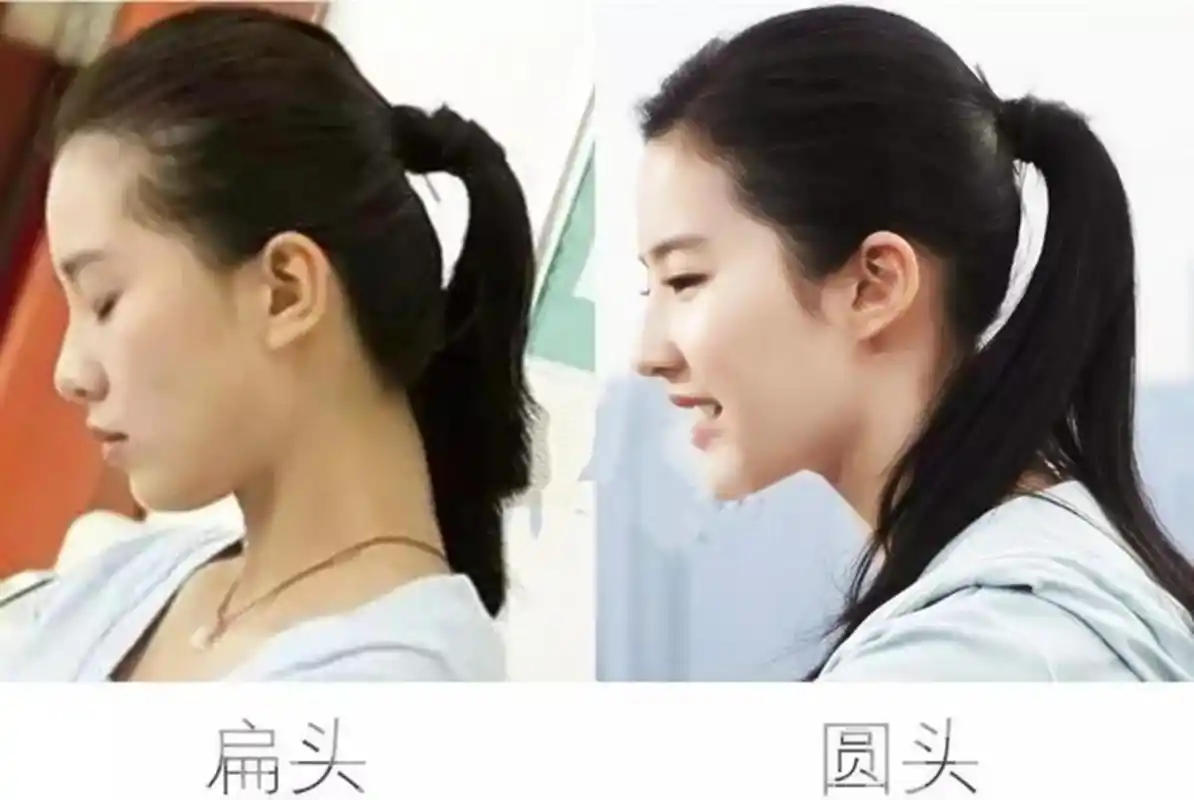 扁头显"脸大"虽然脸型大小和头骨,基因有关,但是不