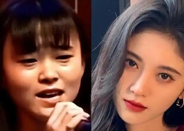 表面"貌若天仙",实则"歪瓜裂枣",这6位女明星整得太惊艳