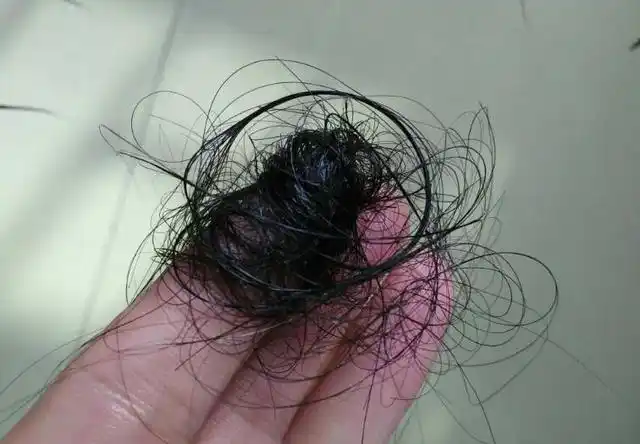 生完娃以后,为啥头发大把大把地掉?知道原因就好解决了