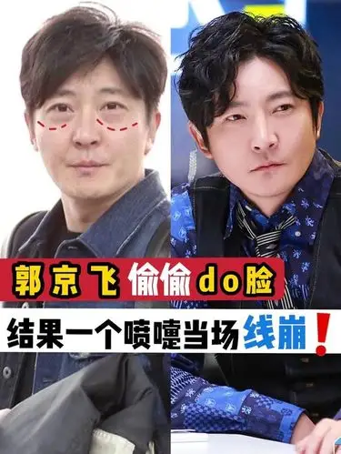 "郭京飞录节目中途离场_圈子-新氧美容整形