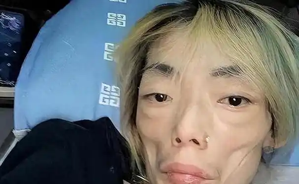 陈鲁豫,瘦成皮包骨,惊呆众人!