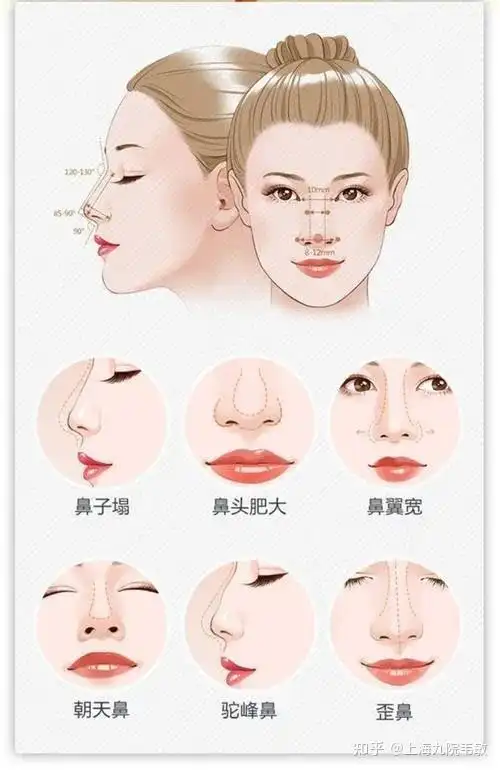 通过这个方式整形如何成功修复鼻翼缺损