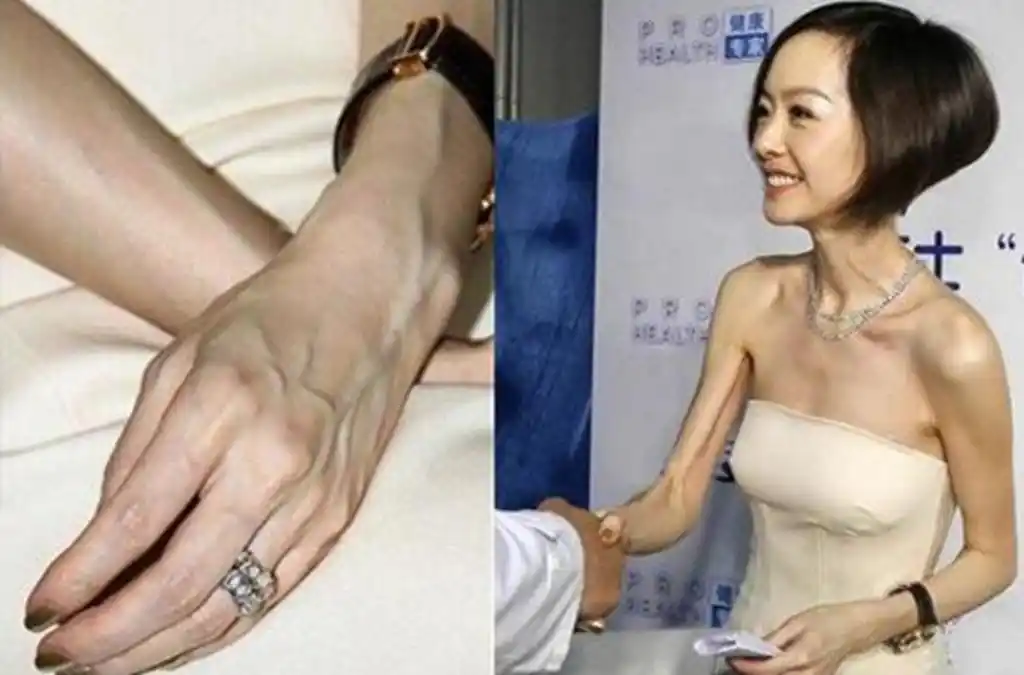 娱乐圈里的女明星,瘦到让人心疼,最后一位却是瘦到可怕!