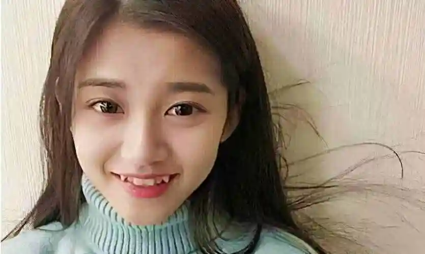 虎牙的形成常常是由于乳牙掉落得比较早,旁边的恒牙长出来过后向缝隙