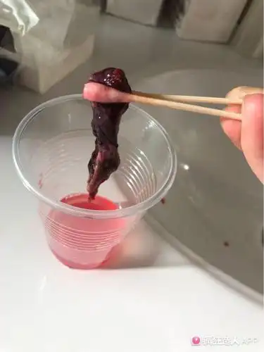 姐妹们,胎停自然流产,帮我看下这个是孕囊吗?