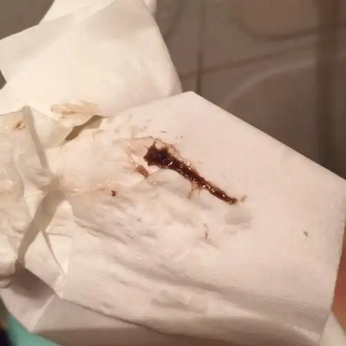 有可能是先兆流产的迹象,怀孕后只要是出现阴道出血及小腹疼痛症状,都