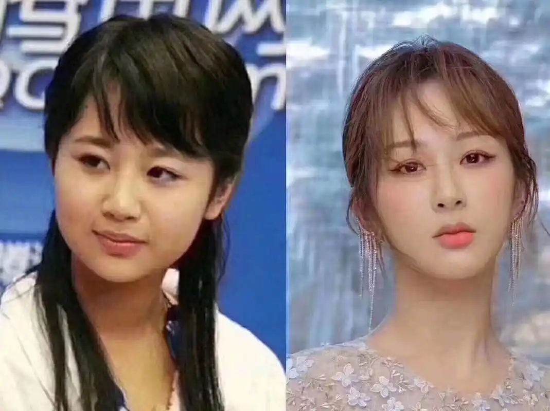 杨紫出入整形医院做了些什么扒一扒杨紫整容史