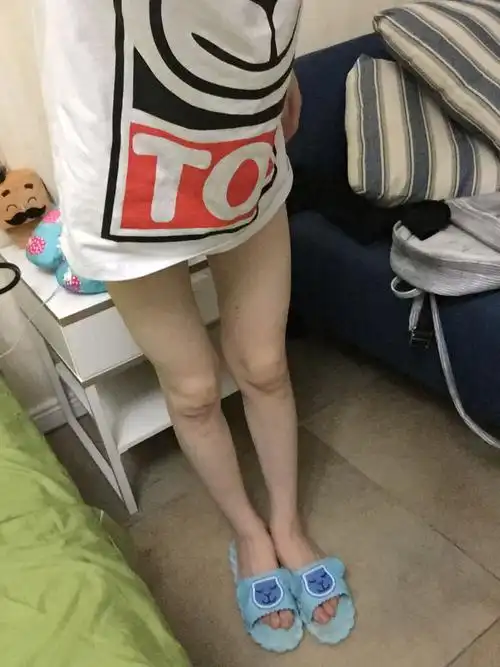 大腿和小腿中间没肉 怎么办 需要怎么治疗 有什么补救办法 太难看了