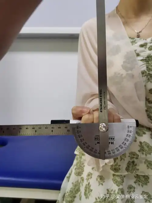 三,腕关节:在掌屈,背伸轴向上的功能位为掌屈1002～背伸1002,在尺