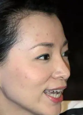 组图明星皮肤问题严重雷倒人