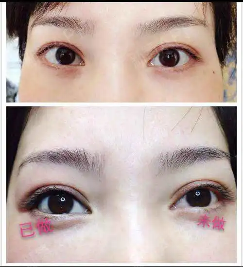 北京半永久美瞳线好不好_效果图_氧气yvnyo半永久美瞳线术后第7天