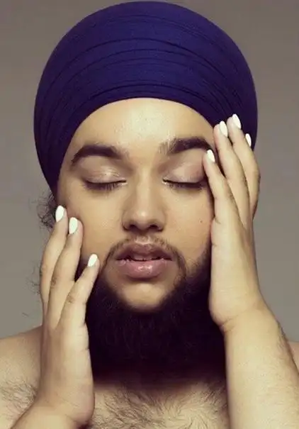 24岁姑娘得怪病满脸大胡子