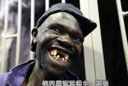 选丑比赛冠军被嫌弃不太丑