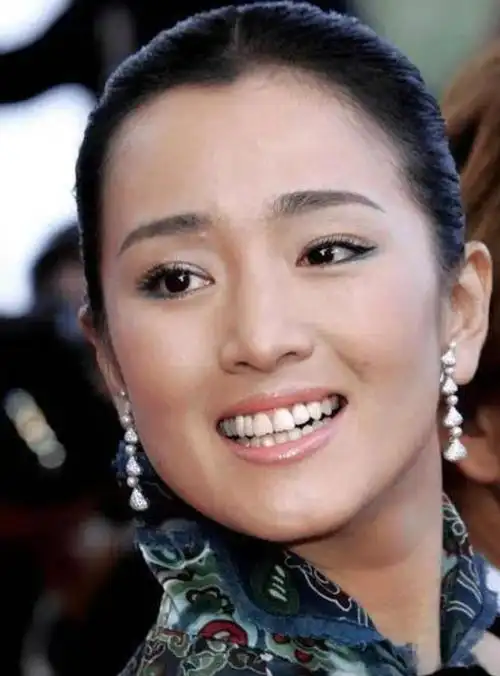 娱乐圈越来越多的明星为了上镜好看开始整牙,也有不少为了在镜头前让