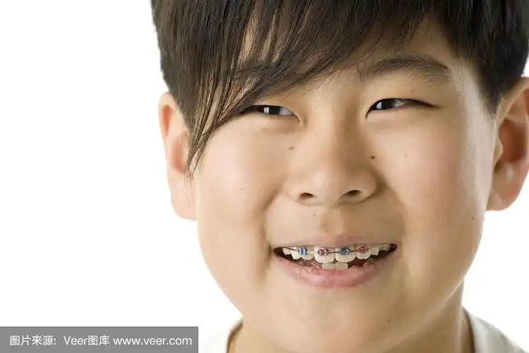 快乐的亚洲男孩戴着牙套