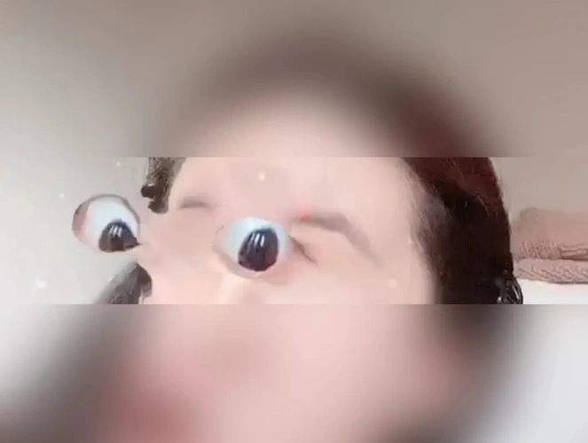 浙江6岁男童抠到眼球淤血,鼓出,因模仿特效视频