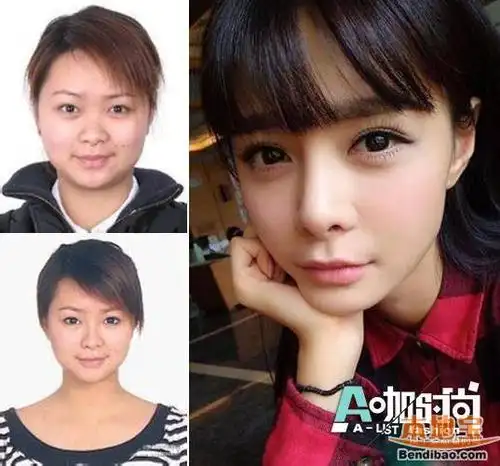 沈梦辰整容前后对比照曝光 10年村姑变女神