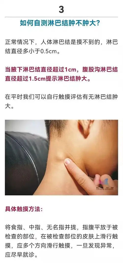 淋巴结肿大可能疼比不疼好这些部位摸一摸可自查