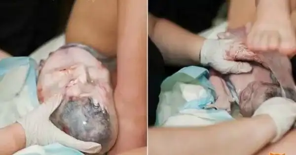 帮助母亲生产的是女儿.