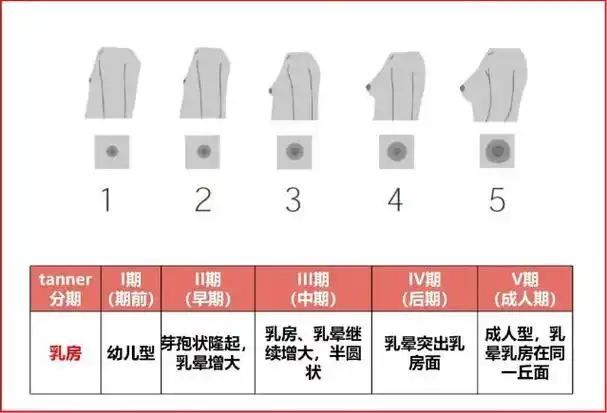 我们先来看一下女性乳房发育的五个阶段:那么,女孩到底什么时候应该