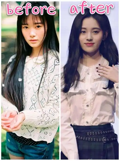 从土味少女到四千年美女鞠婧祎地整容可谓是整形模板不仅整得十分自然
