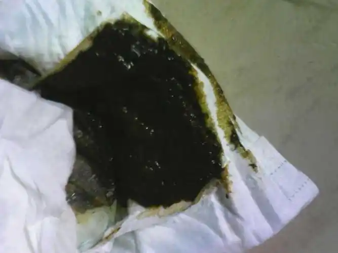 我家宝宝刚刚拉了黑色的大便怎么会是黑色的,我想问是不是有问题啊