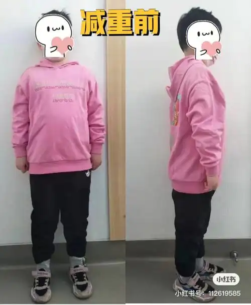 7岁女童69天减重142斤长高4cm