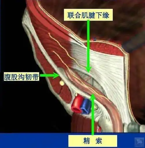 岐黄针治疗腹股沟韧带拉伤病例分享