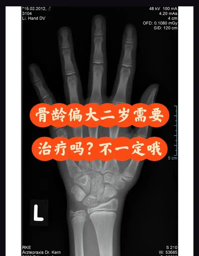 骨龄偏大二岁需要治疗吗?不一定哦.2012年2月15日,男孩 - 抖音