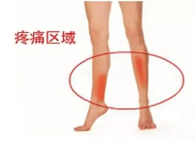 图13 胫骨前肌力量训练 图14 胫骨后肌力量训练图12:臀中肌力量训练图