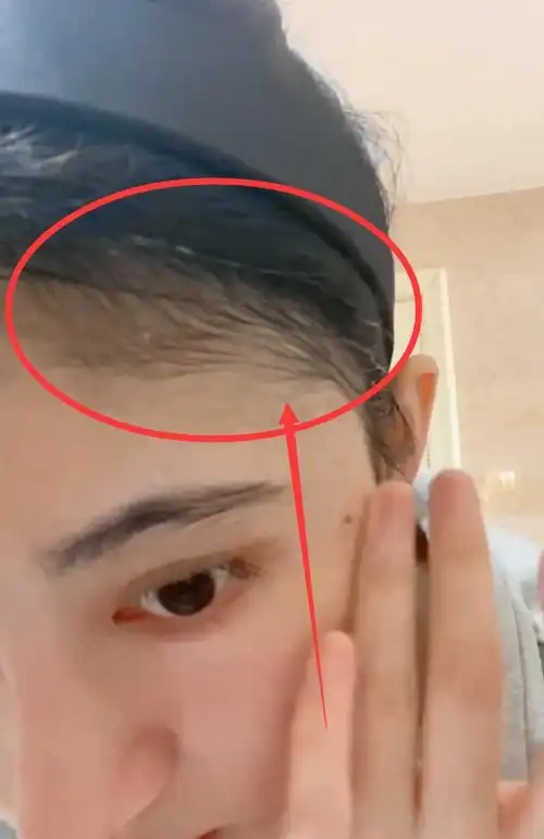 有一种发量过剩叫鞠婧祎,别人发际线在脑门,她都长到脸上去了!