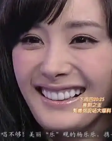 大家看杨幂的牙齿是真的假的?