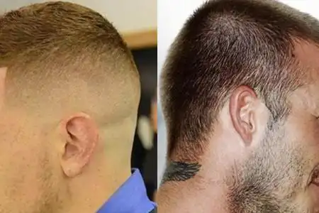 自己剃寸头后脑勺剃法 让你也能独立完成漂亮的发型