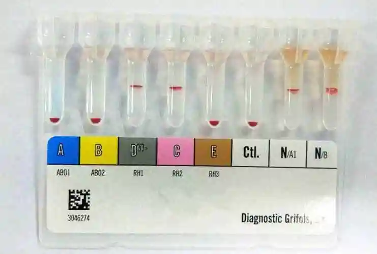 患者血型鉴定结果(卡法)每个人都具有abo血型中的某种抗原及相应的