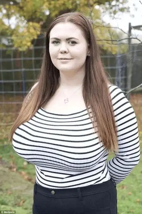 k罩杯巨乳女网上筹款欲做缩胸术称一直受大胸困扰很绝望