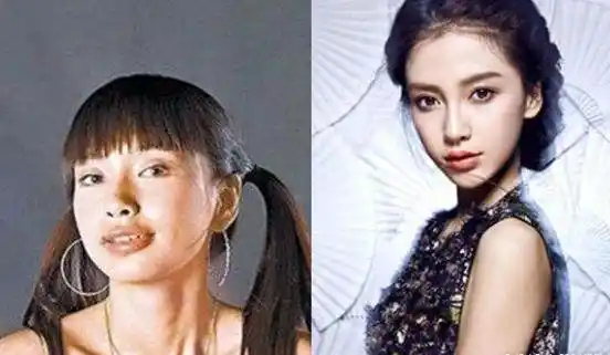 不过清纯的李小璐却由于整容产生了重大的后遗症,眼睛和脸型变得越来