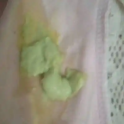 孕妇白带发绿但是不痒怎么办_发型图片